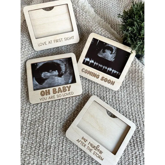 Ultrasound Photo Frames