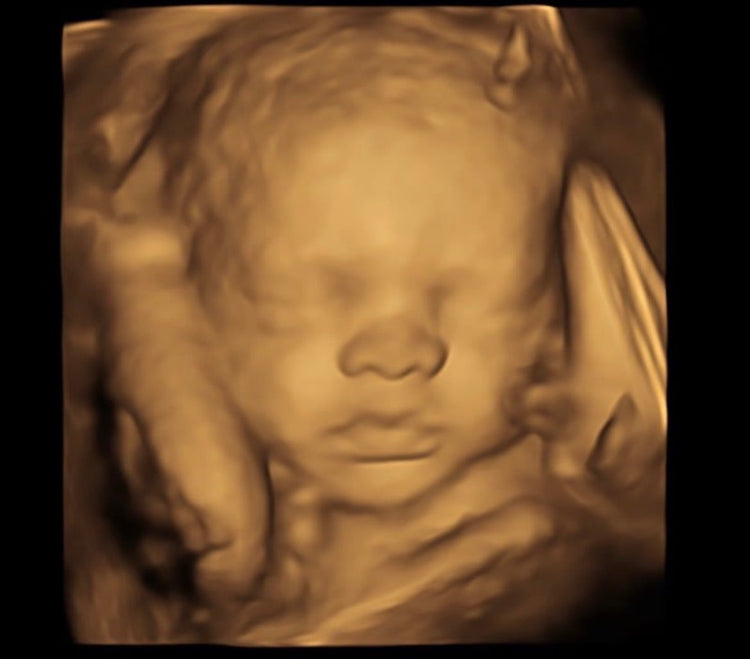 Bump To Baby Ultrasound